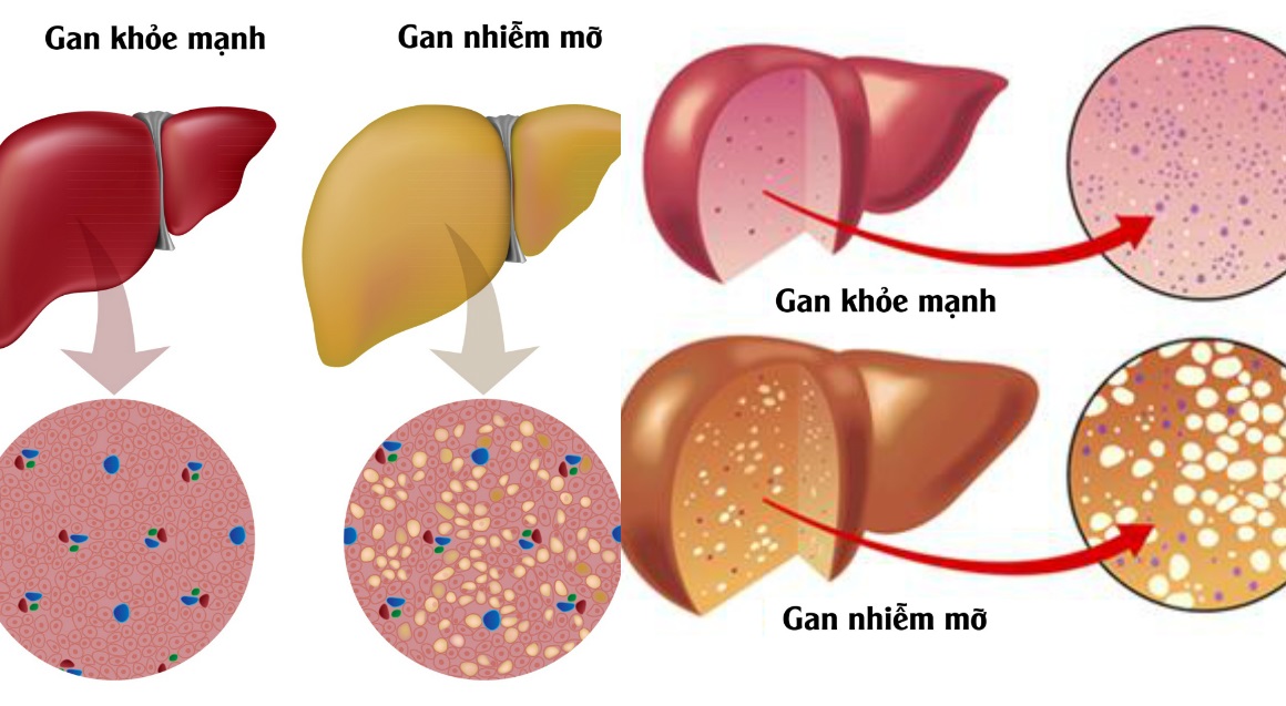 loi ich cua vien uong Liver Detox Costar