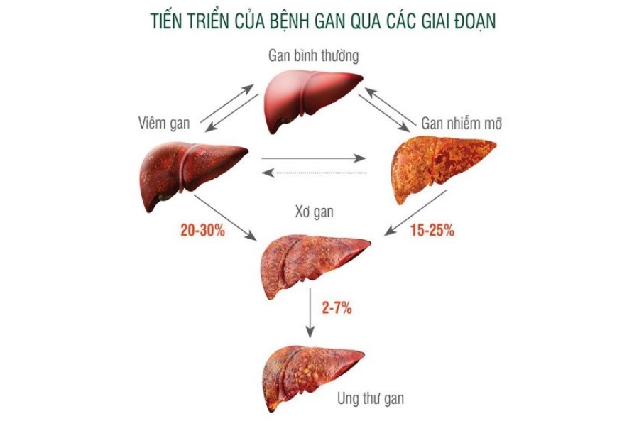 uong giai doc gan khi nao