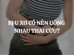 Bị u xơ có nên uống nhau thai cừu không? Ai nên uống nhau thai cừu?