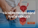 Các bệnh thường gặp ở tuyến tiền liệt là gì? Các phương pháp điều trị