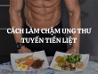 8 cách làm chậm ung thư tuyến tiền liệt cần áp dụng ngay