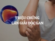 Triệu chứng cần giải độc gan: Nhận biết sớm để bảo vệ sức khỏe