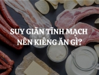 Suy giãn tĩnh mạch nên kiêng ăn gì? Các thực phẩm nên và không nên dùng để cải thiện sức khỏe