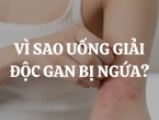 Vì sao uống thuốc giải độc gan bị ngứa? Có nên dùng viên uống giải độc gan Liver Detox Costar 35000mg?